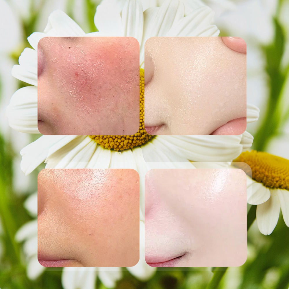 Face Mask Skincare - قناع الوجه من فيكلي روز فيتامين