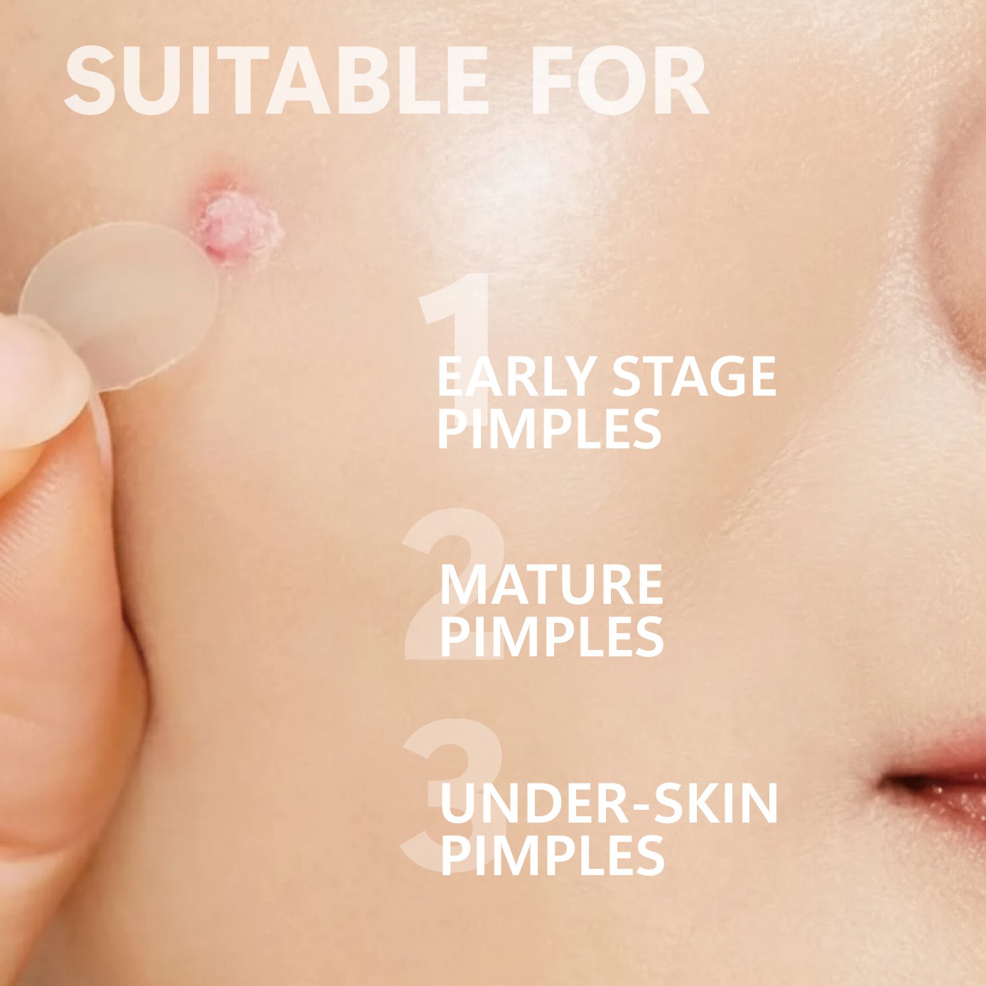 لاصقات مايكرو نيدل لعلاج البثو - مراجعة Face Moisturizer وسعره