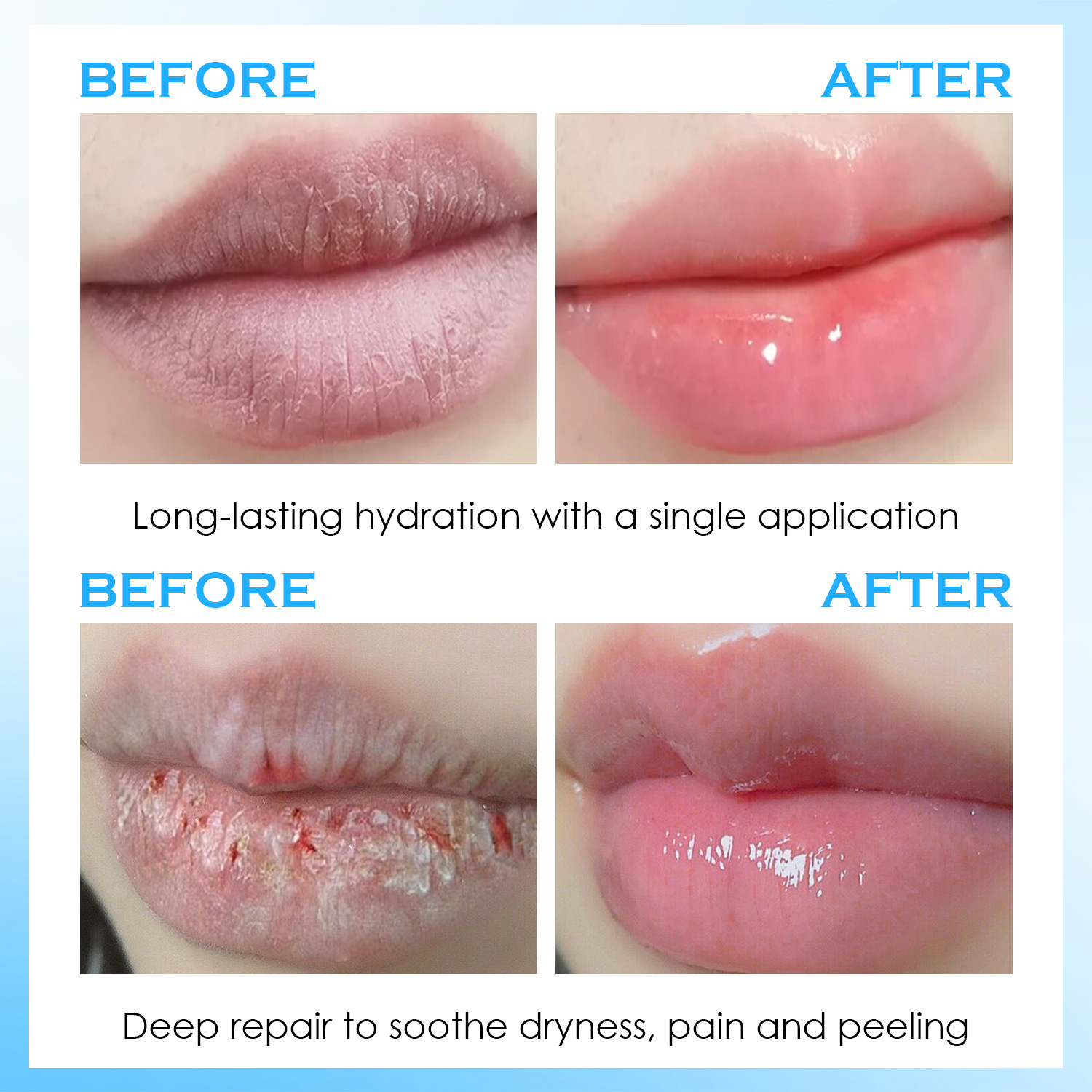 سيروم للشفاه، بلسم مرطب، علاج  - مراجعة Lip Balm وسعره