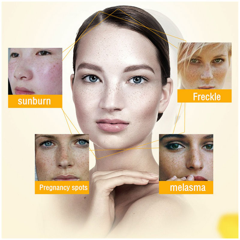 Dimollaure كريم تبييض النمش تر - مراجعة Night Cream وسعره