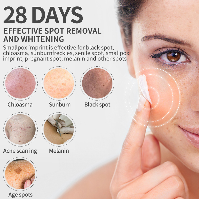 Dimollaure كريم تبييض النمش تر - مراجعة Night Cream وسعره