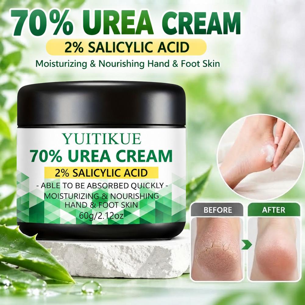 كريم يوريا 70% وحمض الساليسيلي - مراجعة Urea Foot Cream وسعره